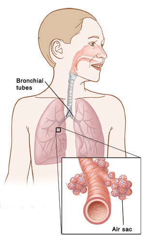 Ilustración que muestra la posición de los pulmones y los bronquios con un primer plano de un alvéolo.