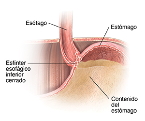 Primer plano de corte transversal de la parte superior del estómago, la parte inferior del esófago y el diafragma. El esfínter esofágico inferior está cerrado y mantiene el contenido del estómago dentro de este.