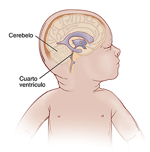 Vista lateral de la cabeza de un bebé donde se observan los ventrículos normales en el cerebro.